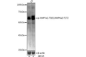 Western blot analysis of extracts of C6 cells, using Phospho-AMPKa1-T183/AMPKa2-T172 antibody (ABIN3020441, ABIN3020442, ABIN3020443 and ABIN1681942) at 1:1000 dilution. (AMPK alpha antibody  (pThr172))