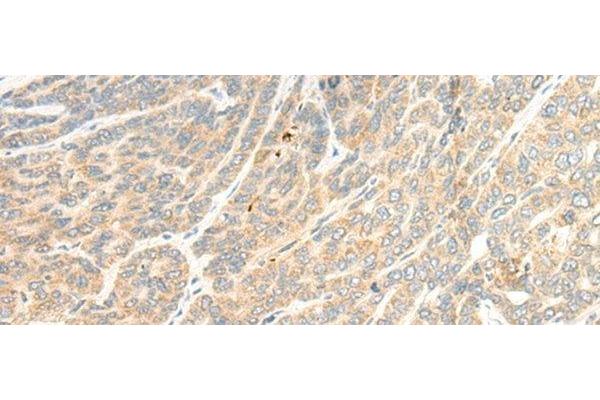 TTC4 antibody