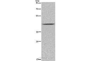 Western blot analysis of Mouse liver tissue, using JMJD6 Polyclonal Antibody at dilution of 1:800 (JMJD6 antibody)