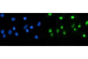 IF analysis of USP5 using anti-USP5 antibody (ABIN7599551). (USP5 antibody  (AA 1-800))