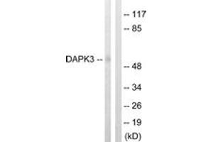 Western blot analysis of extracts from HuvEc cells, using DAPK3 (Ab-265) Antibody.