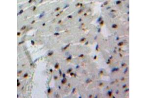 #VALUE! (EBF1 antibody  (AA 179-451))