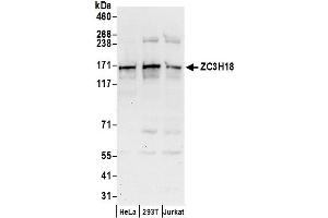 anti-Zinc Finger CCCH-Type Containing 18 (ZC3H18) (AA 903-953) antibody