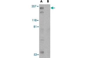Western blot analysis of TSC2 in L1210 cell lysate with TSC2 polyclonal antibody  at 1 ug/mL in the (A) absence and (B) presence of blocking peptide. (Tuberin antibody  (C-Term))
