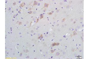 Formalin-fixed and paraffin embedded rat brain tissue labeled with Anti-SCD1 Polyclonal Antibody, Unconjugated (ABIN704111) at 1:200 followed by conjugation to the secondary antibody and DAB staining (SCD antibody  (AA 265-359))
