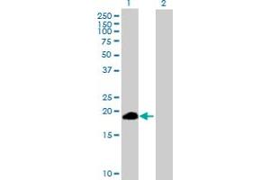 Western Blot analysis of ZSCAN1 expression in transfected 293T cell line by ZSCAN1 MaxPab polyclonal antibody. (ZSCAN1 antibody  (AA 1-178))