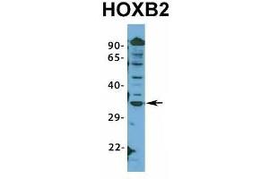 Host:  Rabbit  Target Name:  HOXB2  Sample Type:  HepG2  Antibody Dilution:  1. (HOXB2 antibody  (N-Term))