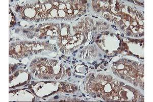 Immunohistochemical staining of paraffin-embedded Human Kidney tissue using anti-AKT1 mouse monoclonal antibody.