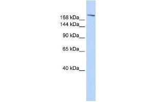 Western Blot showing CCNB3 antibody used at a concentration of 1-2 ug/ml to detect its target protein.