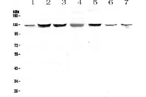 Western blot analysis of SMC6L1 using anti-SMC6L1 antibody . (SMC6 antibody  (AA 205-443))