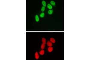 SMARCB1 antibody (mAb) (Clone 2C2) tested by immunofluorescence. (SMARCB1 antibody)