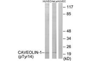 Western blot analysis of extracts from HuvEc cells treated with PMA 125ng/ml 30' and HeLa cells treated with LPS 100ng/ml 30', using Caveolin-1 (Phospho-Tyr14) Antibody. (Caveolin-1 antibody  (pTyr14))