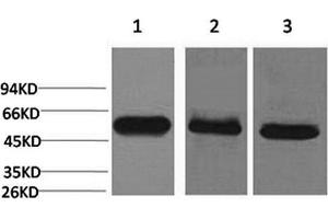 Western Blotting (WB) image for anti-Caspase 8 (CASP8) antibody (ABIN5960798) (Caspase 8 antibody)