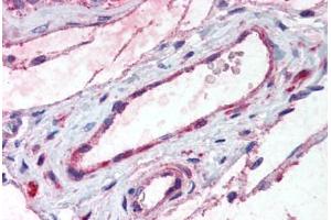 Human Testis, Vessels (formalin-fixed, paraffin-embedded) stained with ADAMTS1 antibody ABIN292613 at 20 ug/ml followed by biotinylated goat anti-rabbit IgG secondary antibody ABIN481713, alkaline phosphatase-streptavidin and chromogen. (ADAMTS1 antibody  (Internal Region))