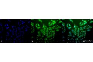 Immunocytochemistry/Immunofluorescence analysis using Mouse Anti-Ubiquitin Monoclonal Antibody, Clone 5B9-B3 . (Ubiquitin antibody  (HRP))