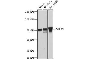 Western blot analysis of extracts of various cell lines, using STK39 Rabbit mAb (ABIN1682890, ABIN3015922, ABIN3015923 and ABIN7101461) at 1:1000 dilution. (STK39 antibody)