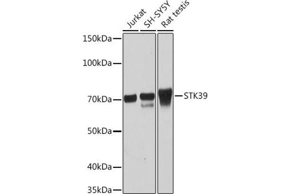 STK39 抗体