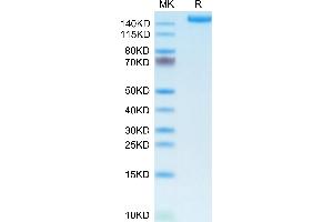 L1CAM Protein (AA 20-1120) (His tag)