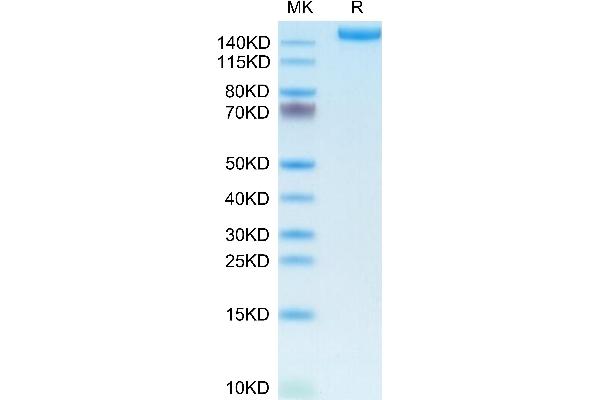 L1CAM Protein (AA 20-1120) (His tag)