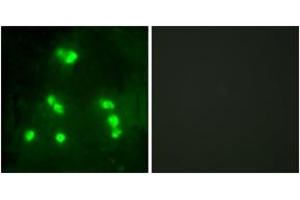 Immunofluorescence analysis of A549 cells, using HAIR Antibody. (Hairless antibody  (AA 41-90))