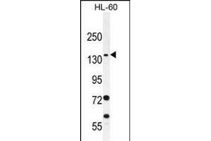 SPECC1 Antibody (Center) (ABIN656081 and ABIN2845427) western blot analysis in HL-60 cell line lysates (35 μg/lane). (NSP5 antibody  (AA 705-733))