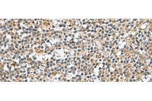 Immunohistochemistry of paraffin-embedded Human tonsil tissue using DNPH1 Polyclonal Antibody at dilution of 1:60(x200) (RCL antibody)