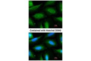 ICC/IF Image Immunofluorescence analysis of methanol-fixed HeLa, using FBXL2, antibody at 1:200 dilution. (FBXL2 antibody  (N-Term))