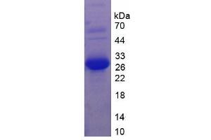 SDS-PAGE analysis of Mouse Laminin alpha 2 Protein. (Laminin Protein)