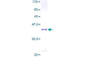 CNN1 Protein (AA 1-297) (GST tag)