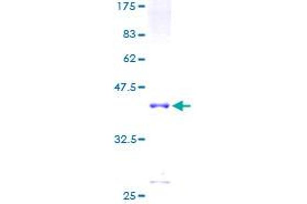 CNN1 Protein (AA 1-297) (GST tag)