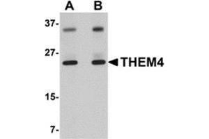 Western blot analysis of THEM4 in human liver tissue lysate with this product at (A) 1 and (B) 2 μg/ml. (THEM4 antibody  (Center))