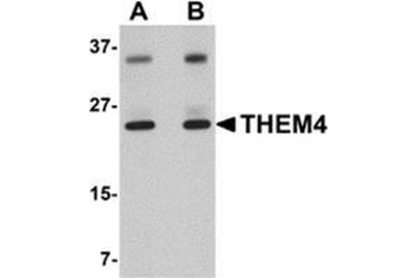 THEM4 antibody  (Center)