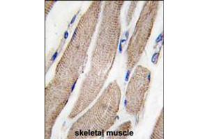 Formalin-fixed and paraffin-embedded human skeletal muscle tissue reacted with MAP2K5 Antibody (S149) , which was peroxidase-conjugated to the secondary antibody, followed by DAB staining. (MAP2K5 antibody  (AA 127-156))