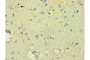 Immunohistochemistry of paraffin-embedded human brain tissue using ABIN7152490 at dilution of 1:100 (FBXW11 antibody  (AA 1-140))