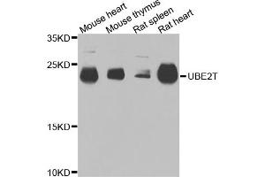 Western blot analysis of extracts of various cell lines, using UBE2T antibody. (Ube2t antibody)