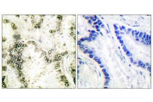 Immunohistochemistry (IHC) image for anti-X-Ray Repair Complementing Defective Repair in Chinese Hamster Cells 6 (XRCC6) (C-Term) antibody (ABIN1848652) (XRCC6 antibody  (C-Term))