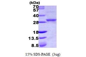 Cytidine Monophosphate (UMP-CMP) Kinase 1, Cytosolic (CMPK1) (AA 1-228) protein (His tag)