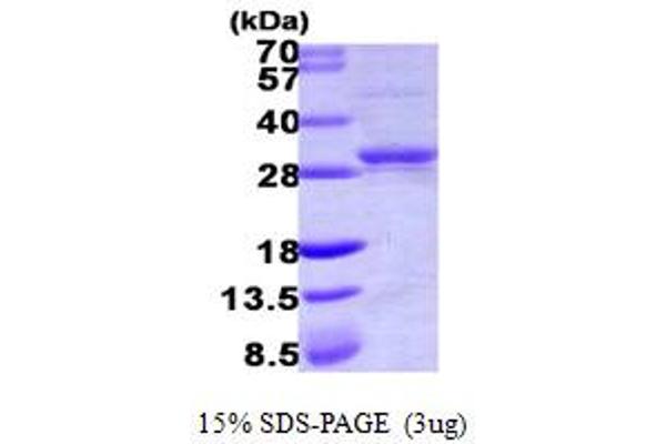 Cytidine Monophosphate (UMP-CMP) Kinase 1, Cytosolic (CMPK1) (AA 1-228) protein (His tag)
