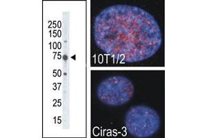 The anti-MSK2 Pab (ABIN390994 and ABIN2837937) is used in Western blot to detect MSK2 in placenta tissue lysate. (MSK2 antibody  (C-Term))