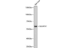 Western blot analysis of extracts of rat liver, using SLC47 antibody (4559) at 1:1000 dilution. (SLC47A1 antibody  (AA 460-550))