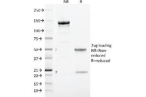 SDS-PAGE (SDS) image for anti-Transferrin Receptor (p90, CD71) (TFRC) (AA 94-212) antibody (ABIN6940699)