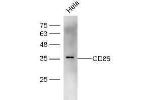 HeLa cell lysates probed with Rabbit Anti-CD86 Polyclonal Antibody, Unconjugated  at 1:500 for 90 min at 37˚C.