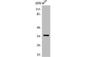 Western Blot analysis of Jurkat cells using Olfactory receptor 5F1 Polyclonal Antibody (OR5F1 antibody  (C-Term))
