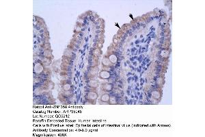 Human Intestine (ZNF358 antibody  (N-Term))