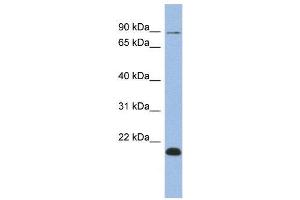 WB Suggested Anti-TCEB3B  Antibody Titration: 0. (TCEB3B antibody  (Middle Region))