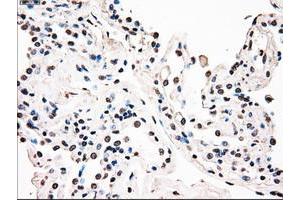 Image no. 1 for anti-B-Raf proto-oncogene, serine/threonine kinase (BRAF) antibody (ABIN1496951) (BRAF antibody)