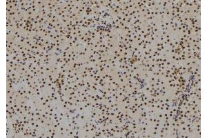 ABIN6279503 at 1/100 staining Mouse kidney tissue by IHC-P. (SIX3 antibody  (C-Term))