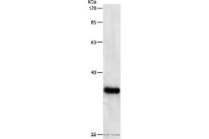 Western blot analysis of Hela cell, using PCNA Polyclonal Antibody at dilution of 1:500 (PCNA antibody)