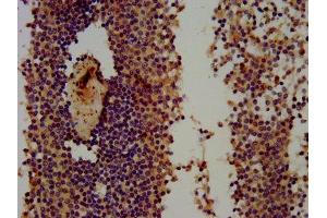 IHC image of ABIN7166179 diluted at 1:300 and staining in paraffin-embedded human spleen tissue performed on a Leica BondTM system. (THEMIS antibody  (AA 547-641))