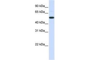 Image no. 1 for anti-DCP2 Decapping Enzyme Homolog (DCP2) (AA 324-373) antibody (ABIN6743046) (DCP2 antibody  (AA 324-373))